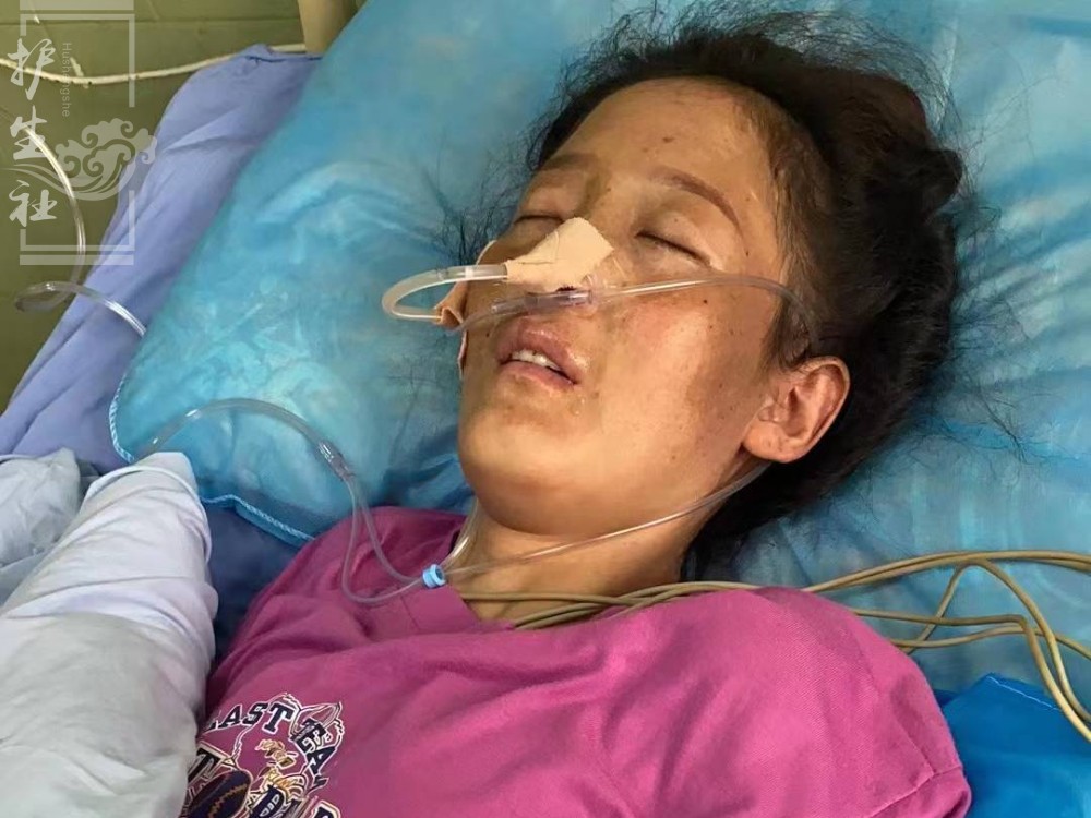 愿坚强的达尔机战胜结核性脑膜炎