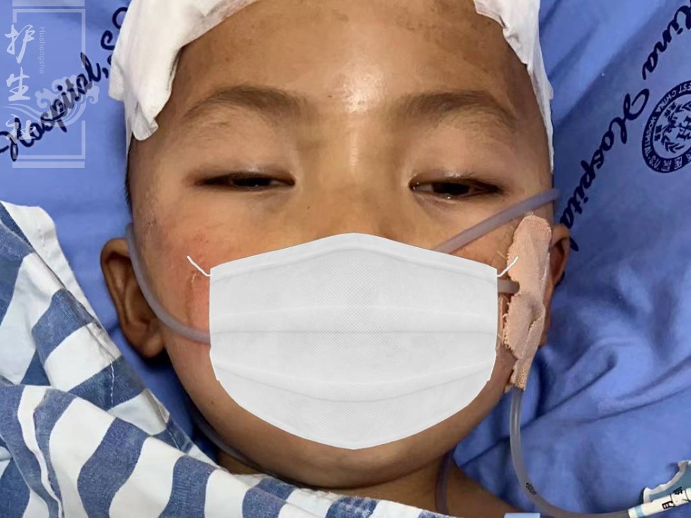 5岁的小卓玛患恶性肿瘤术后还在化疗