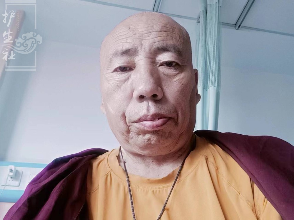  昂翁彭措师父重度贫血，需进一步治疗